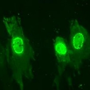 adenovirus bovino
