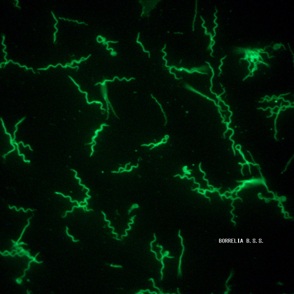 borrelia canis