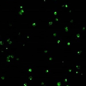 babesia bovis