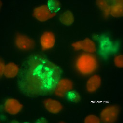 MegaFLUO Anaplasma phagocytophilum